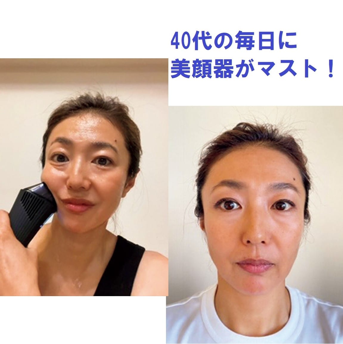 40代美容【ファンデ薄塗りでもキレイ】大人気の美顔器［ReFa ダーマヒート］をお試し【使う度に肌が明るくなる】 | 【公式】GLOW  Online（グローオンライン）