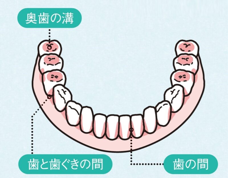 歯みがき　みがき残しポイント