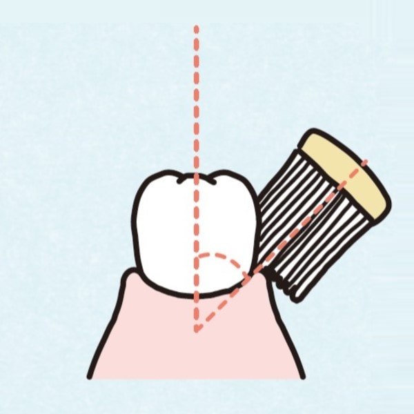 歯茎を気づ付けないみがき方