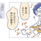 【マンガで更年期】閉経後、原因不明の足のむくみと重さに悩む！『私の生理のしまい方』3-2