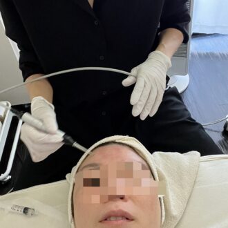エレクトロポレーションでしっかり導入