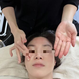 ヒト幹細胞上清液導入