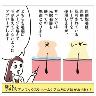 更年期のVIO脱毛　レーザーと光治療の解説