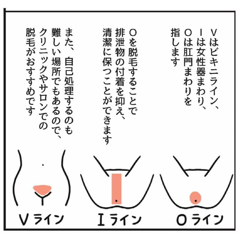 更年期のVIO脱毛タイプ