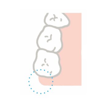 奥歯の磨き方