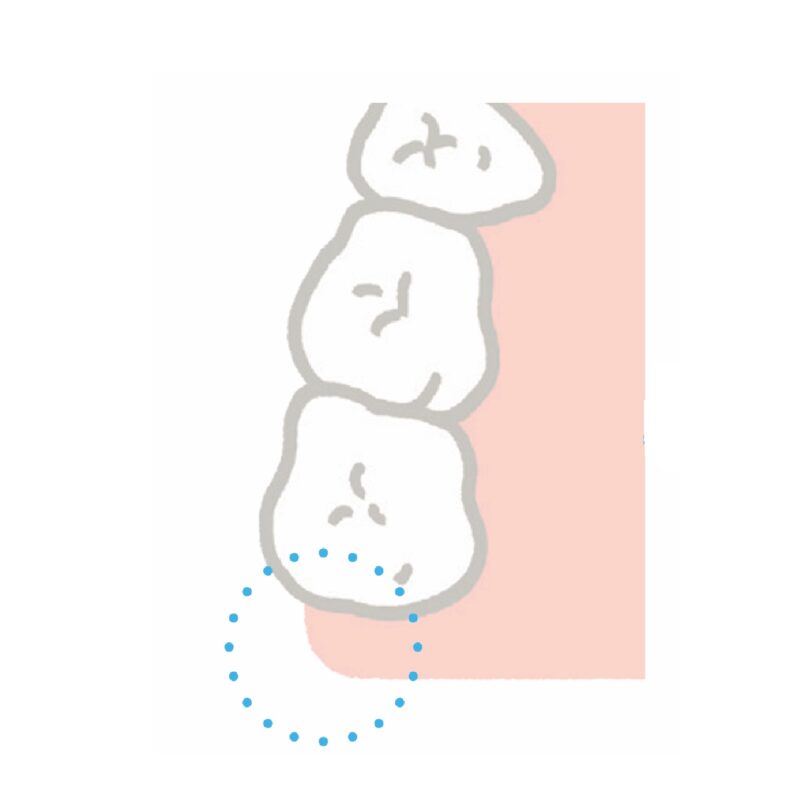奥歯の磨き方