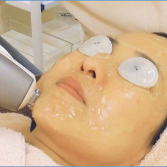 メスのいらないシワ取り治療でリフトアップも！サブライム