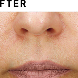 サブライム【AFTER】