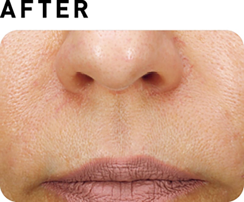 サブライム【AFTER】