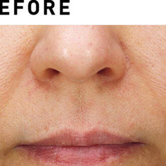 サブライム【BEFORE】