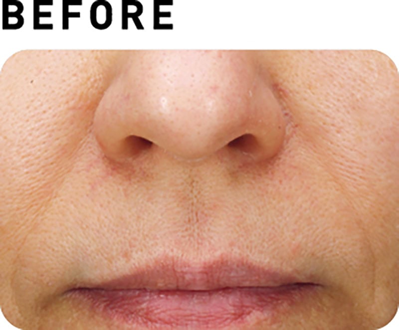 サブライム【BEFORE】