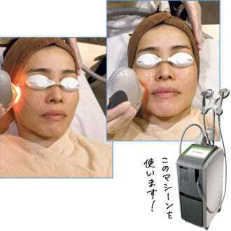 かがやき隊 高本有里子さんが美容医療 タイタンにトライ！