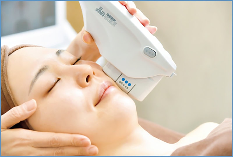 皮膚の深層までをターゲットにするハイフのキング。ウルセラ