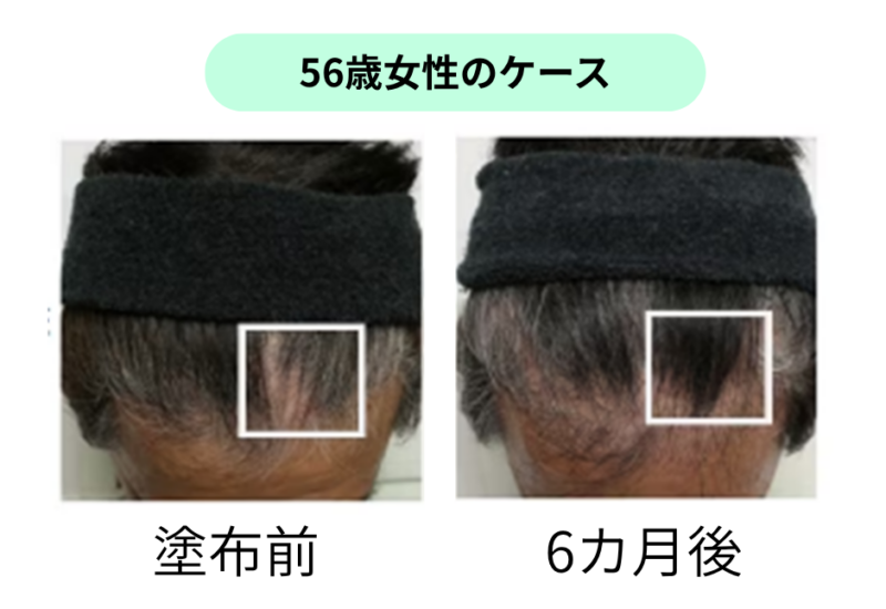 ヤーバサンタ臨床テスト。使用6カ月