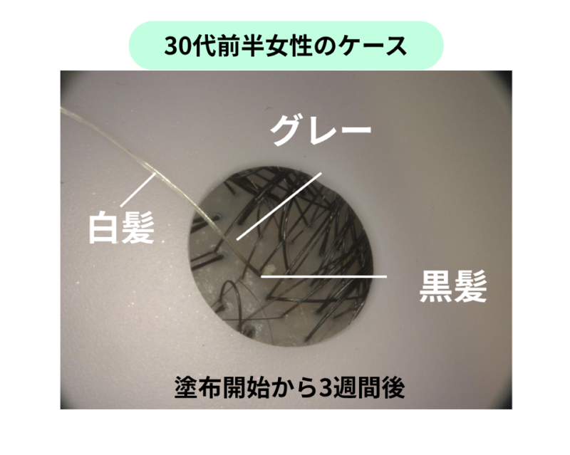 ヤーバサンタ。白髪が黒髪に