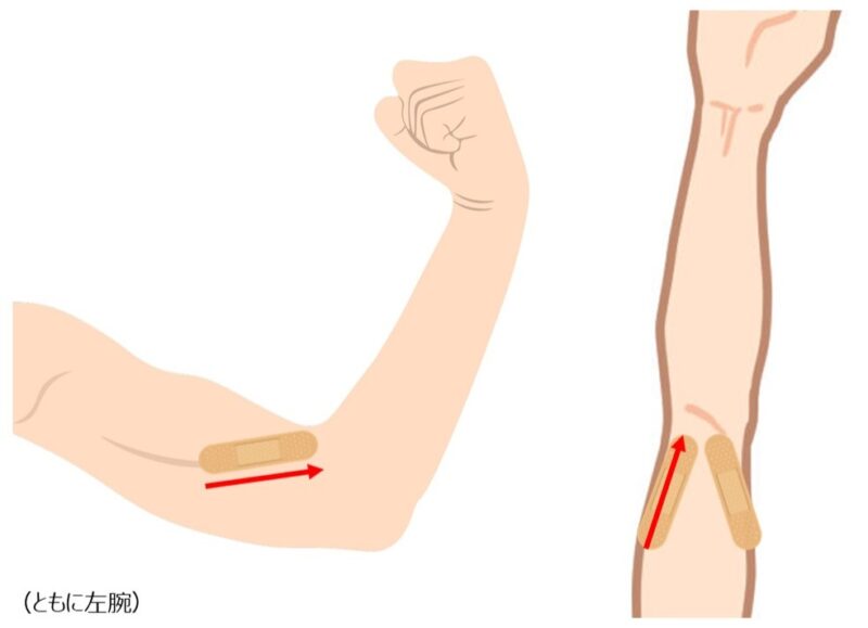 肘カイロのポイント1