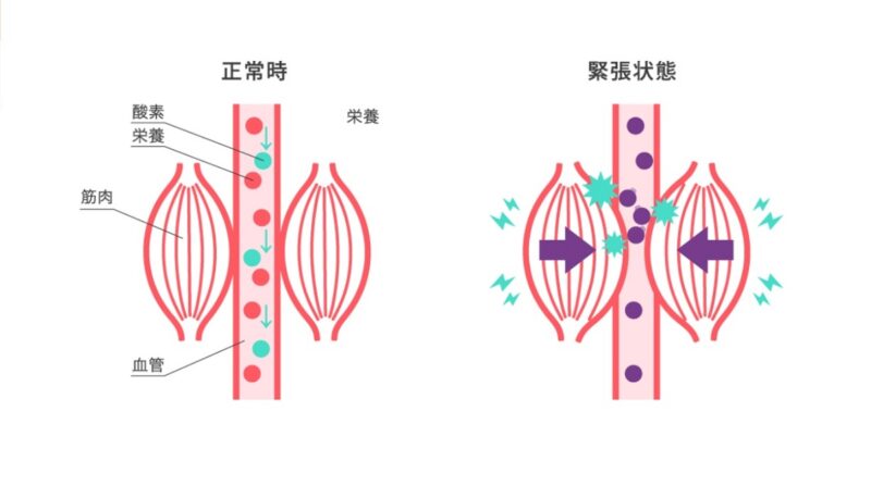 筋肉の疲れを軽減