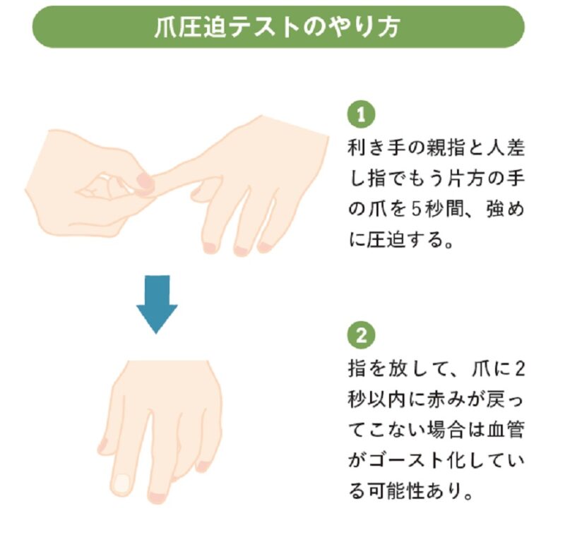 ゴースト血管のチェック方法
