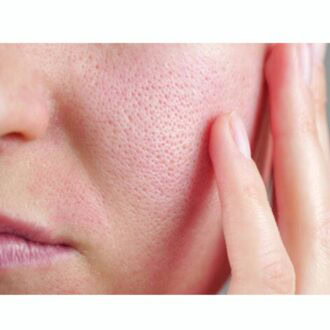 【40代毛穴】その毛穴、汚れじゃないかも？皮膚科医が教える40代からの“取りすぎない“3ステップ｜かがやき隊 ユン ソニョン