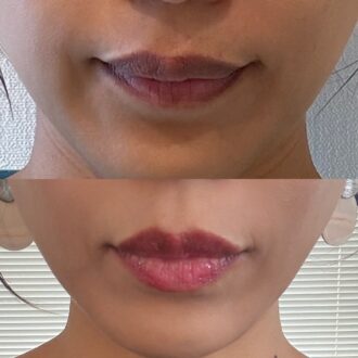 使用ビフォーアフター