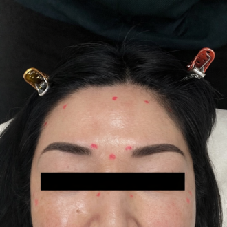 打つ位置をマーキング