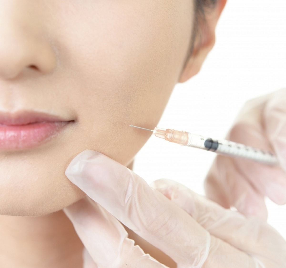 50歳からのシワ対策はボトックス