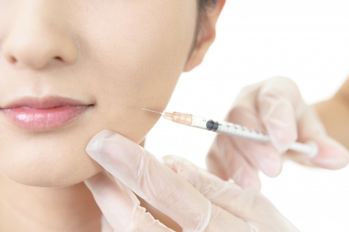 50歳からのシワ対策はボトックス