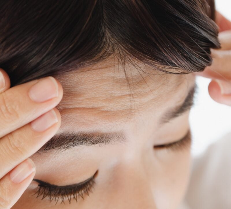 加齢とともに気になる額のシワ