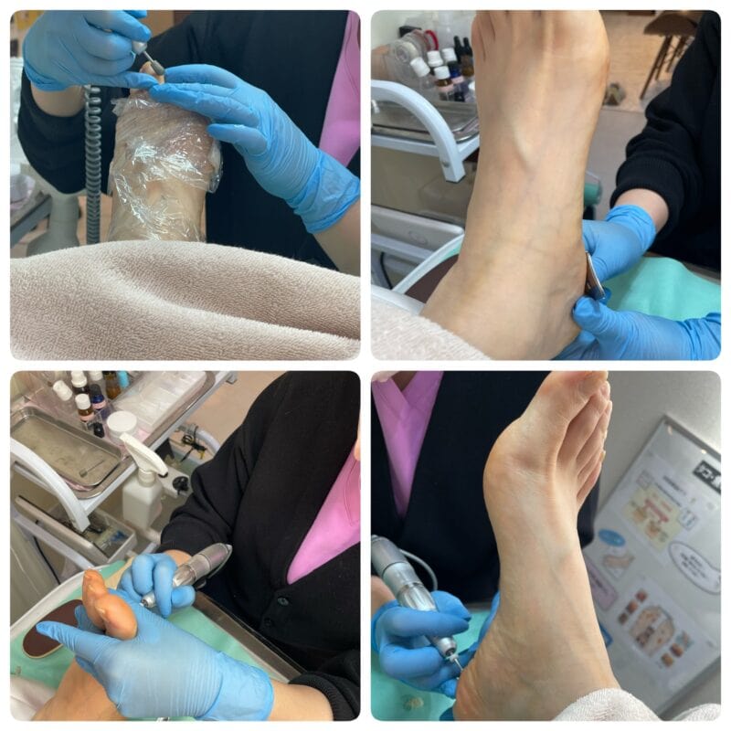 フットケア、してますか?