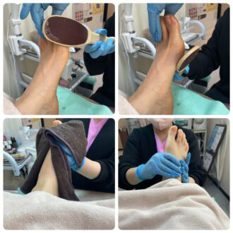 かかとはしっかりとケアしてから夏を迎えたい