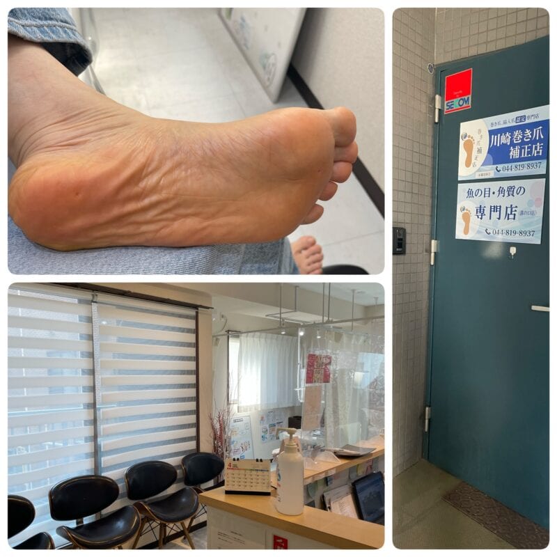 魚の目も取れてスッキリ