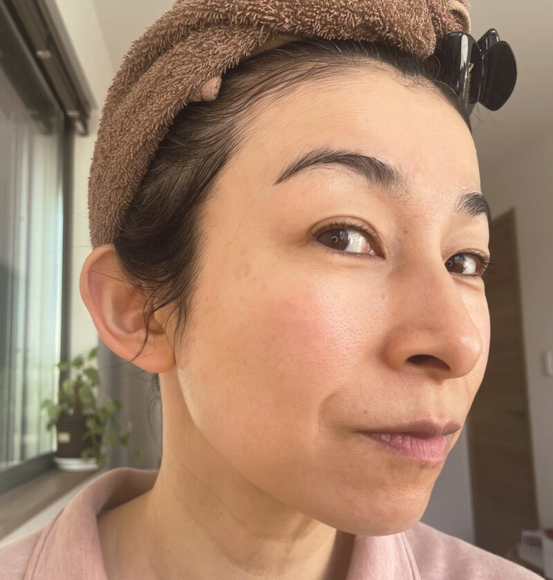 1回の照射で肌がもちもちに